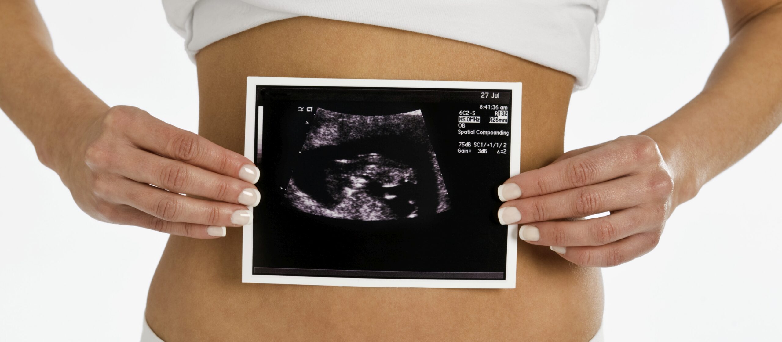 Будет в 44 неделе. УЗИ первый триместр беременности. Диагностика ранних сроков беременности. УЗИ 11 недель беременности.